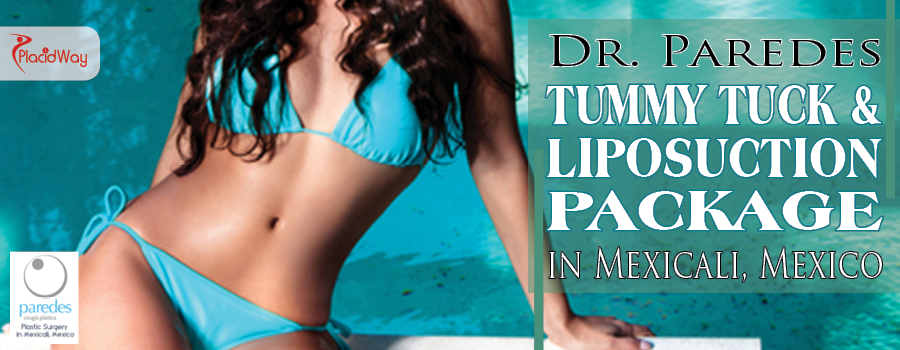 Dr Paredes Tummy Tuck & Liposuction Package in Mexicali Mexico